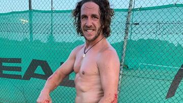 Puyol acaba ensangrentado tras un accidente jugando al pádel