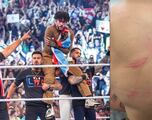 Así quedó la espalda de Bad Bunny tras su participación en WWE desde Puerto Rico