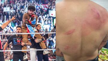 sí quedó la espalda de Bad Bunny tras su participación en WWE desde Puerto Rico