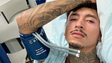 El skater Nyjah Huston con el aparato de la tensi&oacute;n en el brazo y ara triste, en el hospital, a mediados de agosto del 2022, tras haberse roto el ligamento cruzado anterior de la pierna. 