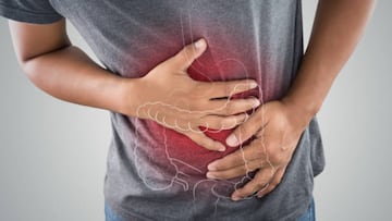 El error que está aumentando la incidencia de cáncer de colon