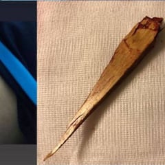 Escalofriante: Bebe se clava una astilla de 10 cm en el primer amistoso del Movistar