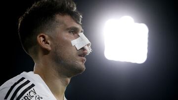 El volante de Unión La Calera recibió tres fechas de castigo luego de su expulsión por el golpe con el que le provocó una fractura nasal al volante de Colo Colo.