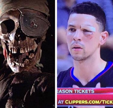 Heroico Rivers: 11 puntos de sutura... y 14 en el tercer cuarto