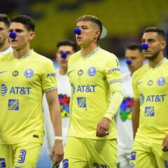 El defensa con el que no contará América hasta el mes de noviembre