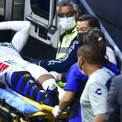 Jorge ‘Burrito’ Hernández se fractura el peroné y se luxa el tobillo