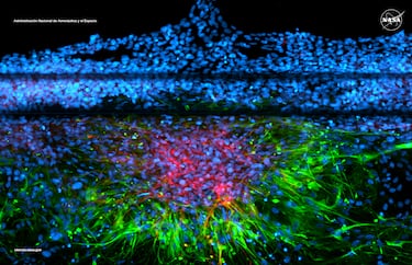 "Mientras la NASA se prepara para regresar a la Luna, es importante estudiar las consecuencias de la radiación espacial en el cuerpo humano y otros riesgos de los vuelos espaciales. Para ello, los investigadores desarrollaron modelos del cerebro humano en un laboratorio y los expusieron a radiación espacial simulada.
Esta imagen capta una variedad de células alrededor de los vasos sanguíneos y muestra cómo los astrocitos, que regulan múltiples aspectos de la salud cerebral, responden a la radiación. Los astrocitos se agrupan formando un patrón similar al de una cicatriz (verde) y expresan una proteína que controla la permeabilidad de los vasos sanguíneos (rojo). Los núcleos celulares aparecen en azul. Estudiar cómo afecta la radiación espacial a las células y a modelos de órganos, incluido el cerebro, permite a los científicos comprender mejor los riesgos para la salud que enfrentan los astronautas y desarrollar contramedidas para proteger a la tripulación en viajes espaciales de larga duración".