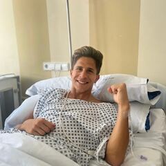 Simeone, operado de una fractura de peroné y luxación de tobillo