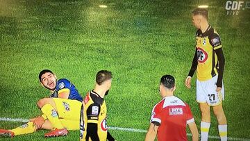 En el partido que abrió la segunda rueda del Torneo Nacional, Luis Riveros sufrió una grave lesión que conmocionó a sus compañeros. El paraguayo retornaba a la actividad.