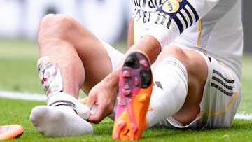 Real Madrid have announced that Dani Carvajal has successfully undergone surgery on his right knee.