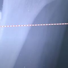 Un médico se implanta 5 microchips en las manos