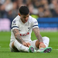 Postecoglou se queda solo