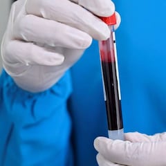 Los graves efectos que el coronavirus puede provocar en la sangre