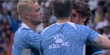 Romero, del centro de la diana a víctima ensangrentada