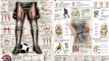 ¡Lesión! La palabra maldita en el mundo del deporte