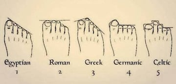 Tipos de pies