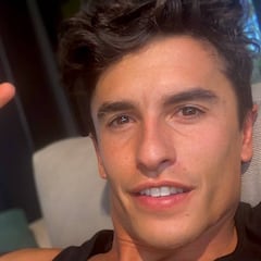 "Un clavo hubiera acelerado la recuperación de Márquez"