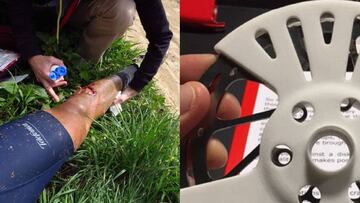 Imagen de un corte en la pierna de Fran Ventoso y un freno de disco protegido para evitar este tipo de accidentes.