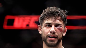 Yair Rodriguez, con el ojo izquierdo hinchado, durante su combate ante Frankie Edgar en elUFC 211 en el American Airlines Center de Dallas.