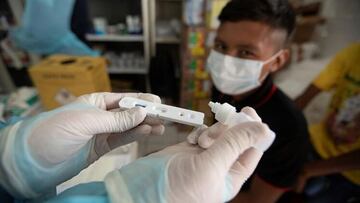 PIMS-TS: el síndrome post covid que afecta a los niños