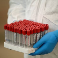 Coronavirus en México: ¿A qué temperatura podría morir el virus?