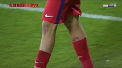 Costa marcó y casi se lesiona: acabó con sangre en la pierna