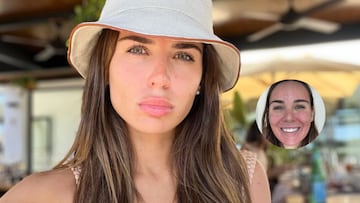 El rostro de Mina Bonino tras un tratamiento estético: “Parece que me ha picado una avispa”