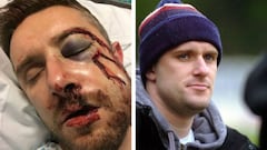 Escalofriante lesión de un jugador en la cuarta inglesa