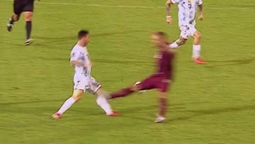 Así vivió Messi la patada que le pudo partir la pierna