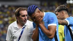 LAS VEGAS, NEVADA - JULY 06: Ronald Araujo of Uruguay reacts after suffering an injury during the CONMEBOL Copa America 2024 quarter-final match between Uruguay and Brazil at Allegiant Stadium on July 06, 2024 in Las Vegas, Nevada.   Candice Ward/Getty Images/AFP (Photo by Candice Ward / GETTY IMAGES NORTH AMERICA / Getty Images via AFP)