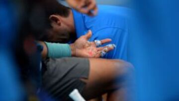 Nadal: "Si se me abre la mano, mi torneo está en peligro"