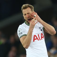 Kane made a big deal over nothing, says Dyche