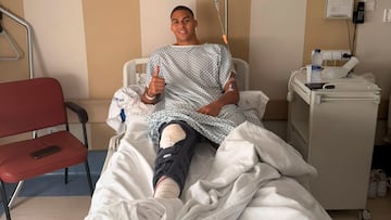 Sannadi, operado y Williams, lesionado, merman el ataque del Athletic