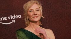 La actriz Anne Heche es desconectada del soporte vital.