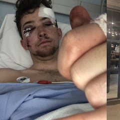 Scott Auld, un ciclista británico, cuenta que una furgoneta le lanzó a un barranco en España