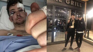 Scott Auld, durante su recuperación en el hospital y tras salir de él.