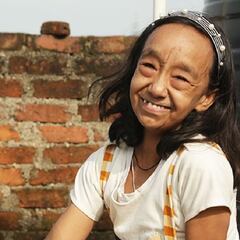 Los hermanos 'Benjamin Button': menores de edad y aparentan tener 80 años