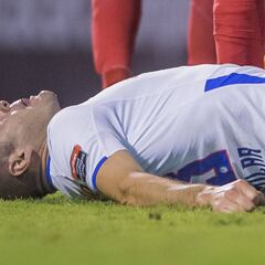 Las 10 lesiones serias que vive la Liga MX