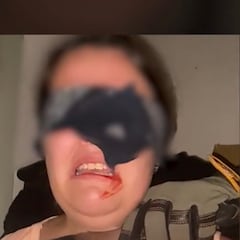 Finge su propio secuestro y le pide 50.000 euros a su madre