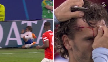 Mbappé respira: no se opera y se decidirá si juega ya este viernes