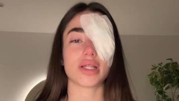 Preocupación por el estado de salud de Lola Lolita tras su última operación: “Espero que sea el fin de esto”