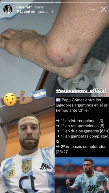 'Papu' Gómez muestra su tobillo en redes tras la batalla en Calama