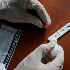 Sanidad advierte: no se puede hacer pruebas a los jugadores de forma indiscriminada