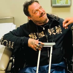 Así ha sido el terrible esguince de ligamento de Bam Margera