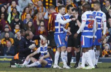 El jugador del Reading FC, Alex Pearce, sufrió un golpe en la nariz que le hizo sangrar tanto que tuvo que desnudarse para poder limpiar toda la sangre y así poder volver al partido contra el Bradford City.
