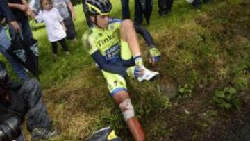 Alberto Contador tras su caída en el Tour en la que se fracturó la tibia.
