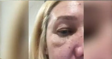 Nannis: "Claudio Caniggia fue violento varias veces, me hizo perder un embarazo"