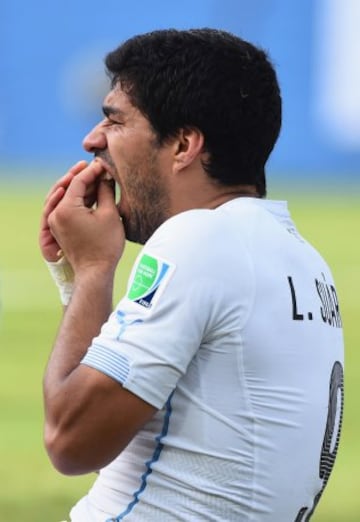 Luis Suarez se toca la dentadura tras su mordisco a Chiellini.