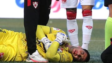 El drama de ex portero azul: “Me lancé, sentí el impacto y me di cuenta que me faltaban dientes”