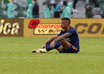 El jugador del Real Madrid ha sufrido una aparatosa caída durante el partido de liga ante el Elche, que le ha supuesto una rotura en la nariz que le hará pasar por el quirófano.